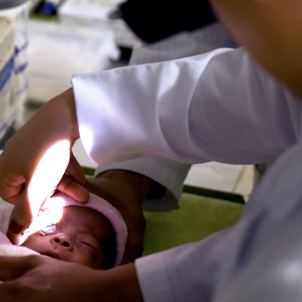 Crowfunding para cirugias de los ojos Mexico