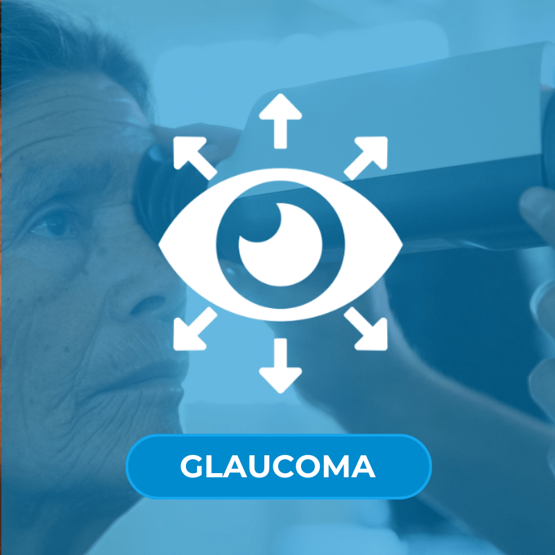 Especialistas en Glaucoma IMO
