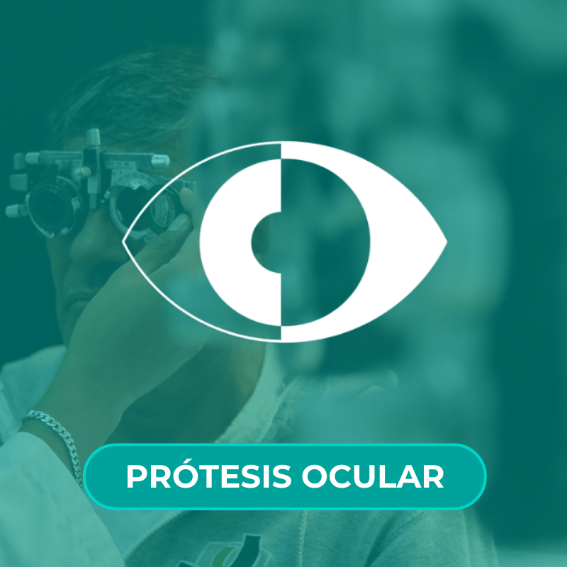 Protesis Ocular IMO Queretaro
