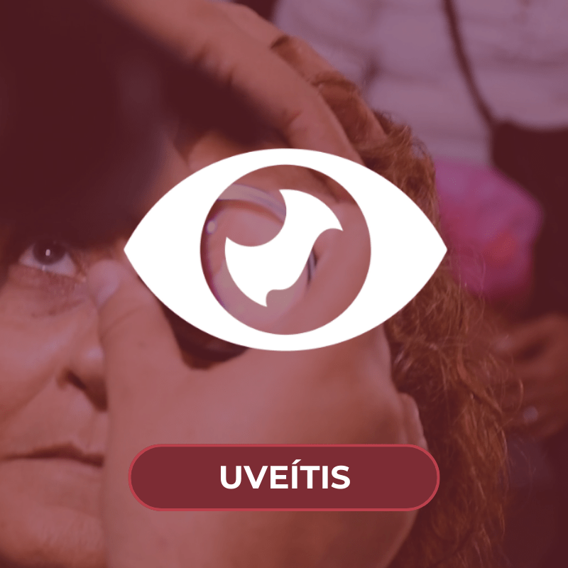 Especialista en Uveitis IMO Queretaro