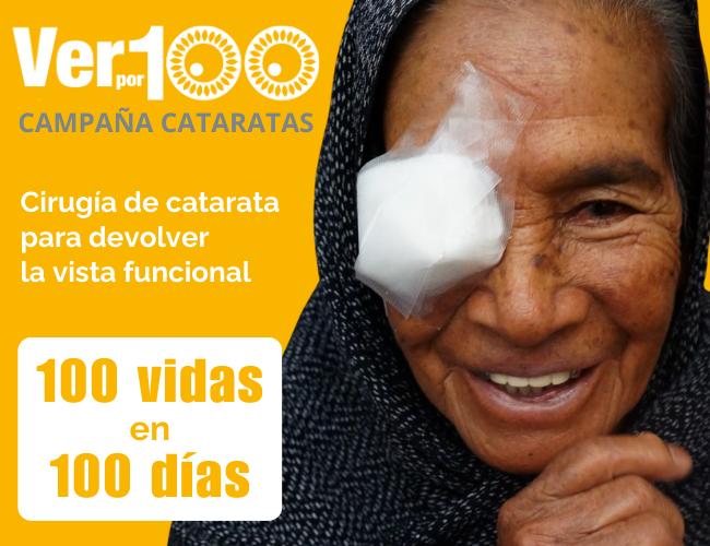 VER 100 Cataratas Donacion